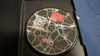 【中古：状態A】MRI tuning